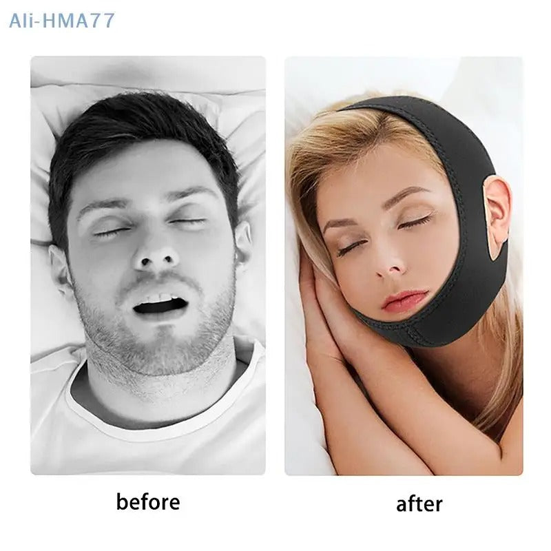 Anti-snoring strap